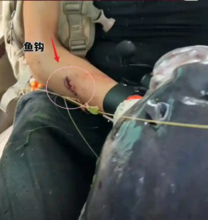 辽宁女子钓中大青鱼，老公摘钩被刺穿手臂，父亲用钳子将鱼钩拔出